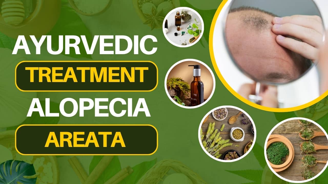 Alopecia Areata Barbae